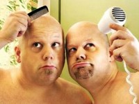Почему выпадают волосы у мужчин? В чём причины?